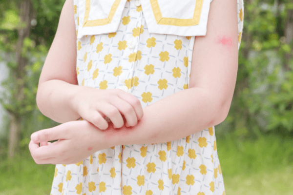 Little girl scratching