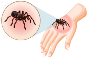 Spider bite